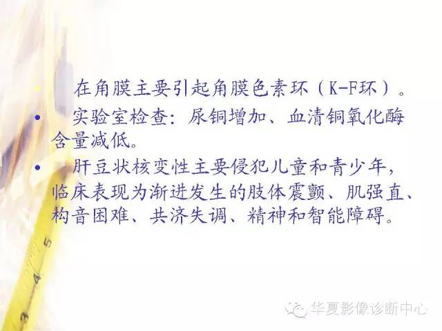 【PPT】肝豆状核变性