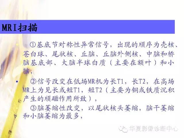 【PPT】肝豆状核变性