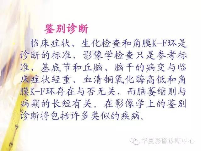 【PPT】肝豆状核变性