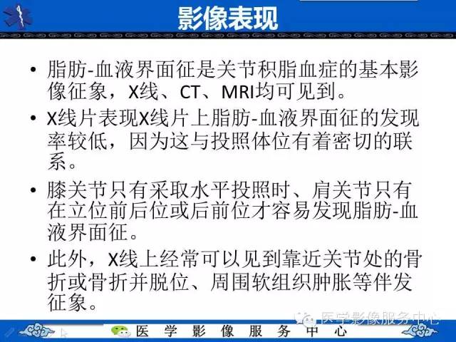 【影像征象】FBI征——脂一液平面征