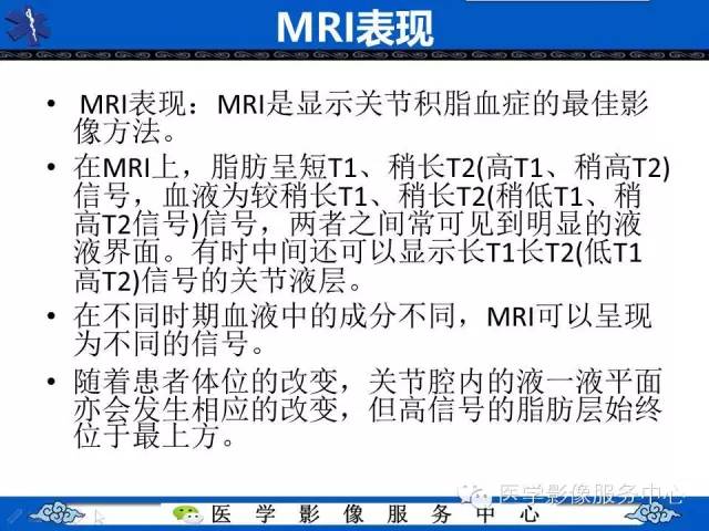 【影像征象】FBI征——脂一液平面征