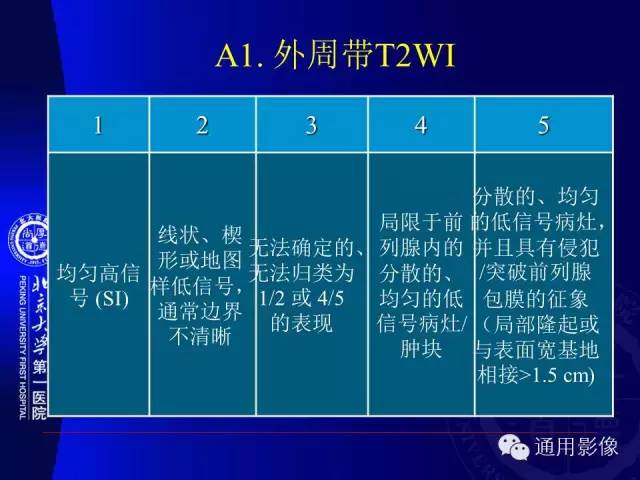 【PPT】前列腺癌的MRI诊断及进展
