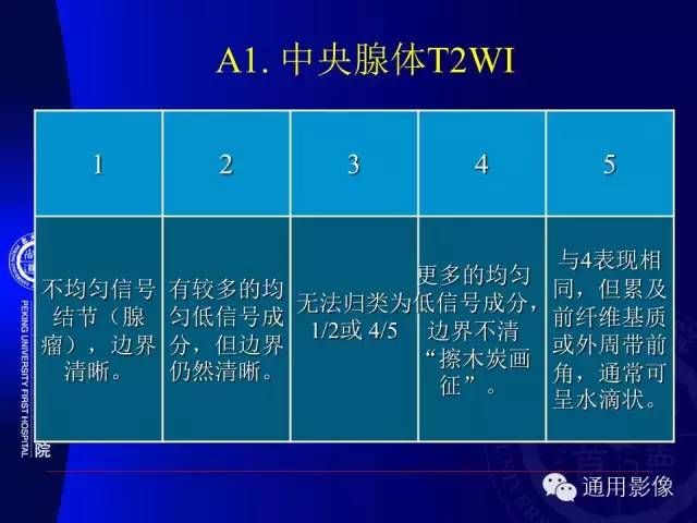 【PPT】前列腺癌的MRI诊断及进展