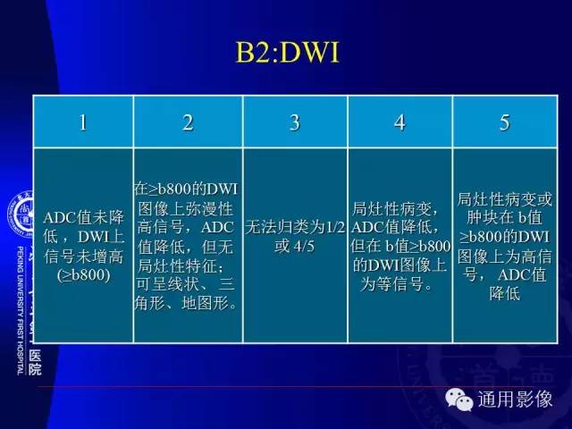 【PPT】前列腺癌的MRI诊断及进展