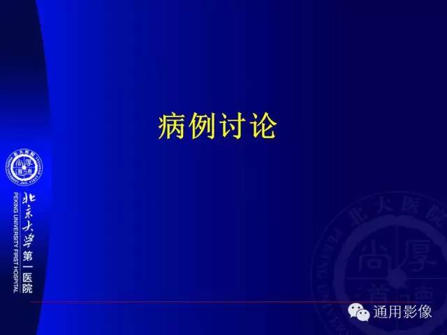 【PPT】前列腺癌的MRI诊断及进展