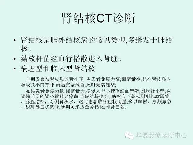 【PPT】肾结核CT诊断