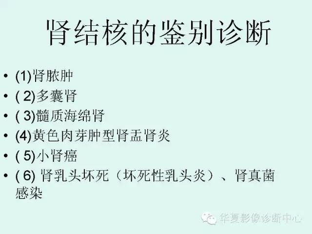 【PPT】肾结核CT诊断