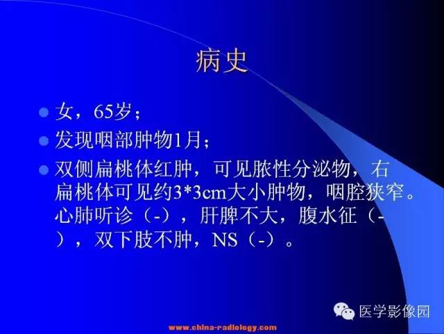 【病例】扁桃体淋巴瘤1例CT影像表现与鉴别