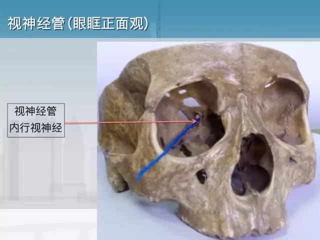 【PPT】鼻咽癌靶区勾画的相关解剖——颅底诸孔