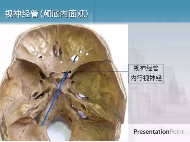 【PPT】鼻咽癌靶区勾画的相关解剖——颅底诸孔