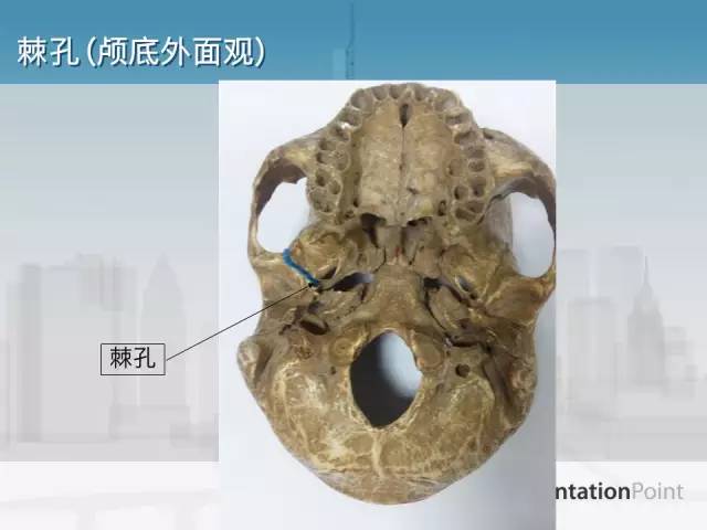 【PPT】鼻咽癌靶区勾画的相关解剖——颅底诸孔