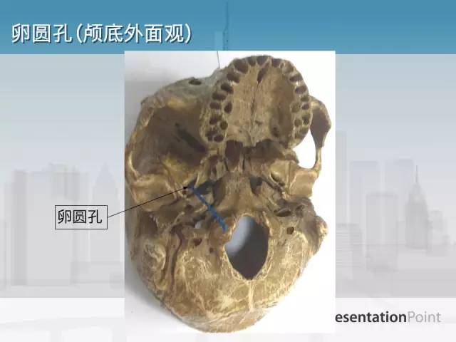 【PPT】鼻咽癌靶区勾画的相关解剖——颅底诸孔