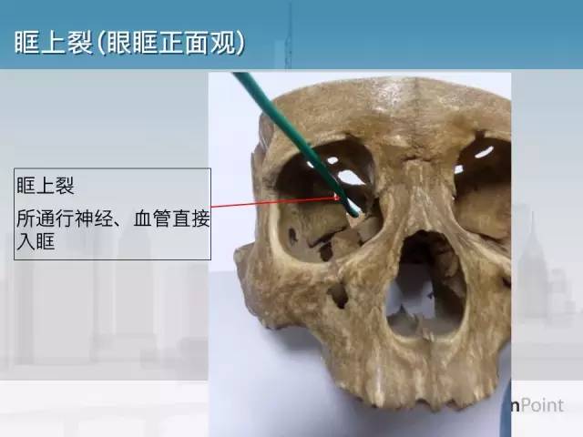 【PPT】鼻咽癌靶区勾画的相关解剖——颅底诸孔