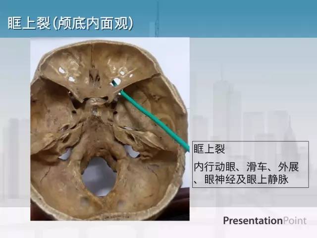 【PPT】鼻咽癌靶区勾画的相关解剖——颅底诸孔