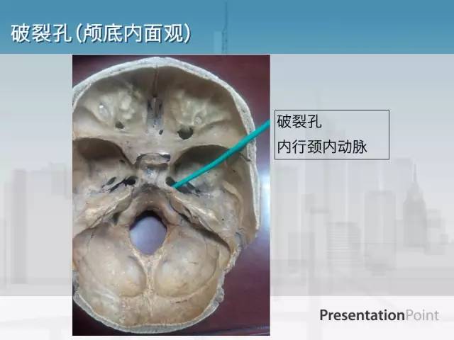 【PPT】鼻咽癌靶区勾画的相关解剖——颅底诸孔