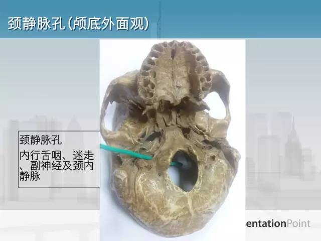 【PPT】鼻咽癌靶区勾画的相关解剖——颅底诸孔