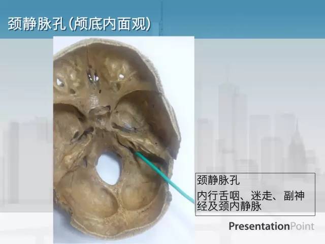 【PPT】鼻咽癌靶区勾画的相关解剖——颅底诸孔