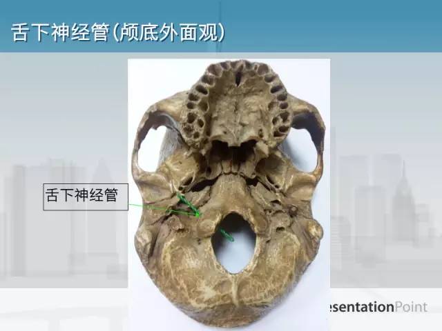 【PPT】鼻咽癌靶区勾画的相关解剖——颅底诸孔