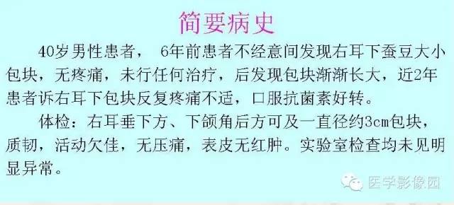 【病例】腮腺腺泡细胞癌1例CT影像表现