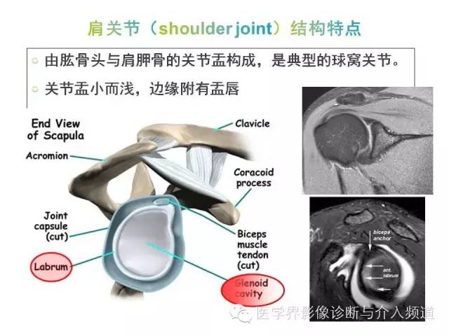 【PPT】肩关节解剖及正常MR表现