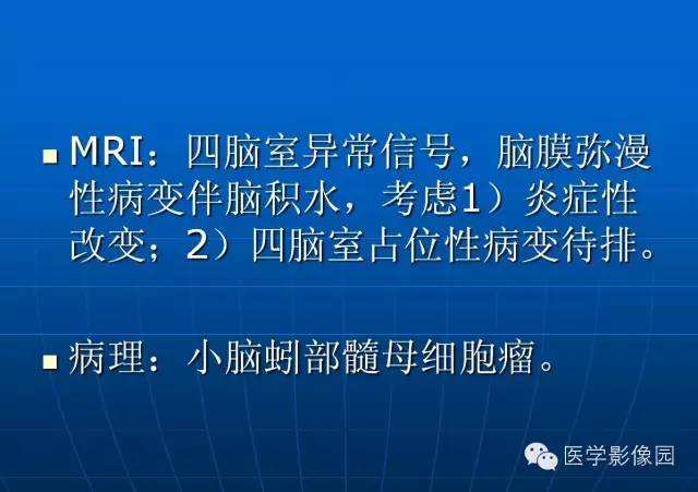 【病例】髓母细胞瘤1例MR影像表现