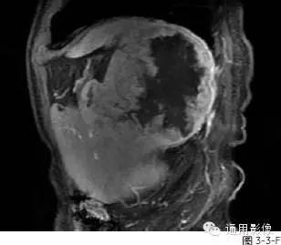 自动草稿 自动草稿