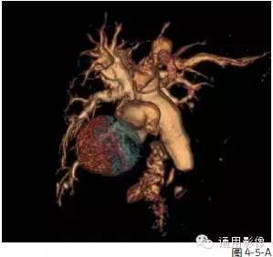 自动草稿 自动草稿