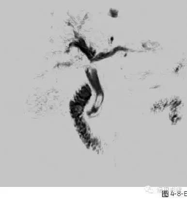 自动草稿 自动草稿