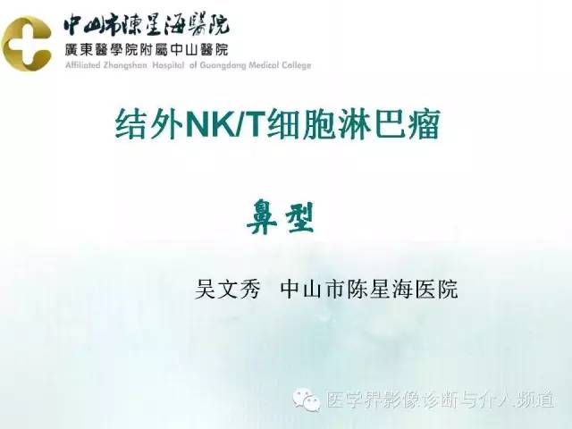 结外NK/T细胞淋巴瘤