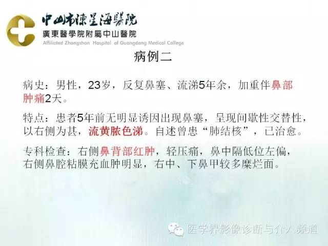 结外NK/T细胞淋巴瘤