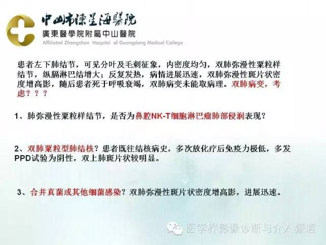 结外NK/T细胞淋巴瘤