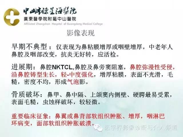 结外NK/T细胞淋巴瘤