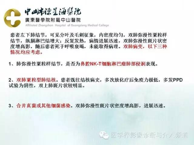 结外NK/T细胞淋巴瘤