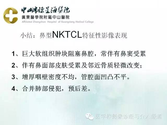 结外NK/T细胞淋巴瘤