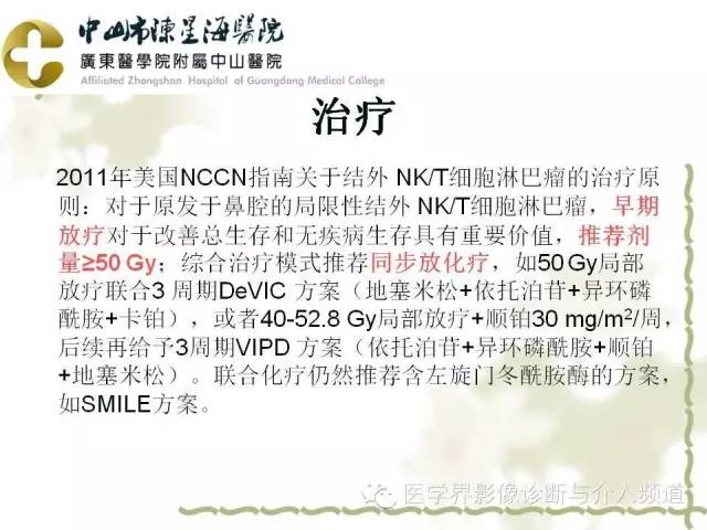 结外NK/T细胞淋巴瘤