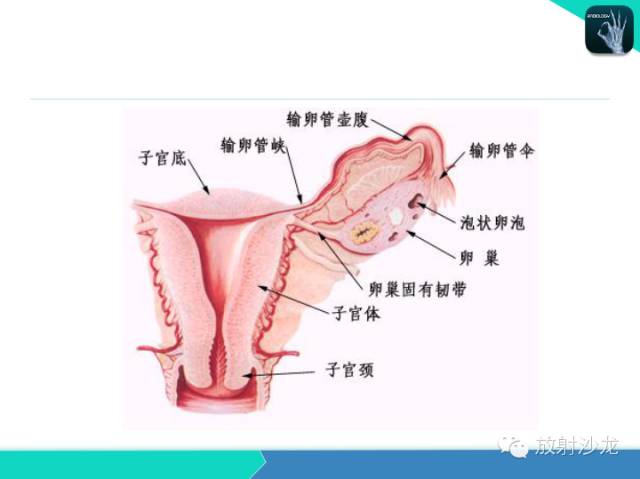 【PPT】子宫输卵管造影