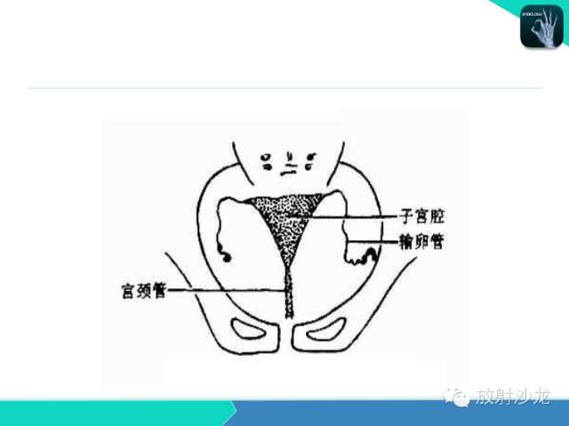 【PPT】子宫输卵管造影