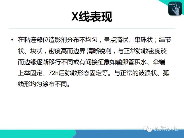 【PPT】子宫输卵管造影