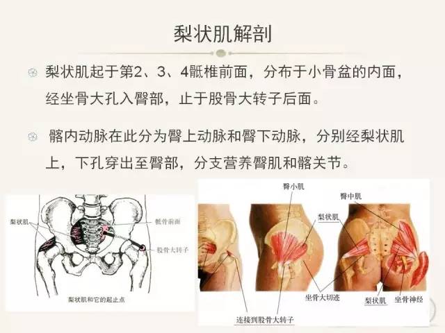 【PPT】梨状肌综合征