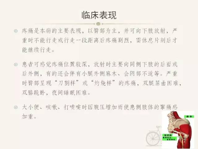 【PPT】梨状肌综合征