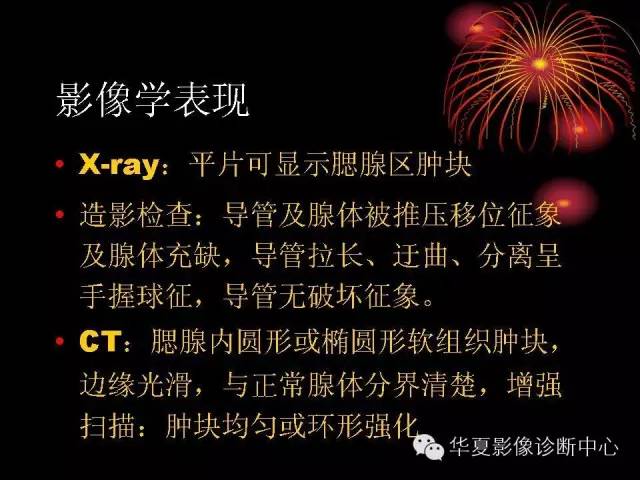 【病例】腮腺常见病变影像诊断