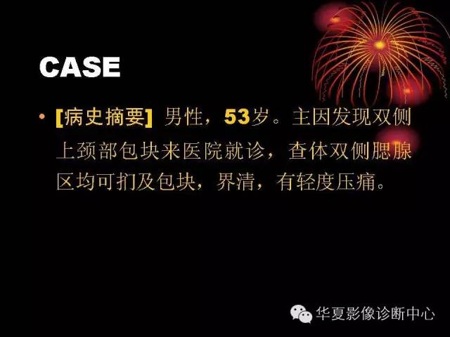 【病例】腮腺常见病变影像诊断