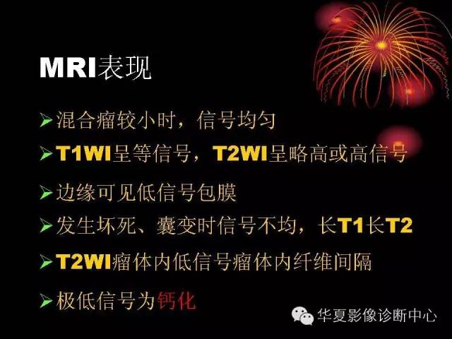 【病例】腮腺常见病变影像诊断