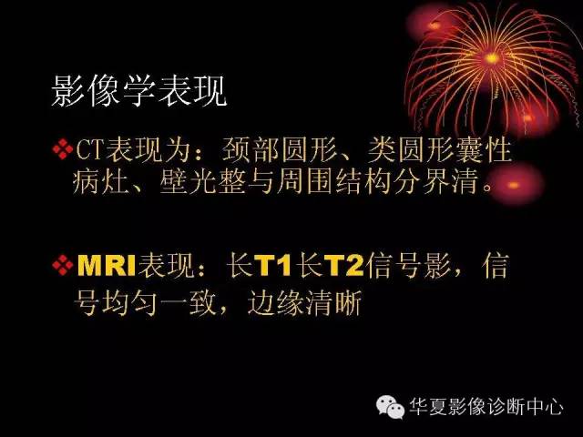 【病例】腮腺常见病变影像诊断