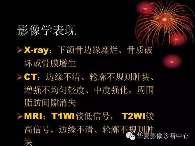 【病例】腮腺常见病变影像诊断