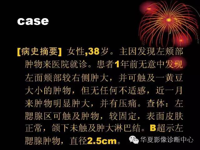 【病例】腮腺常见病变影像诊断