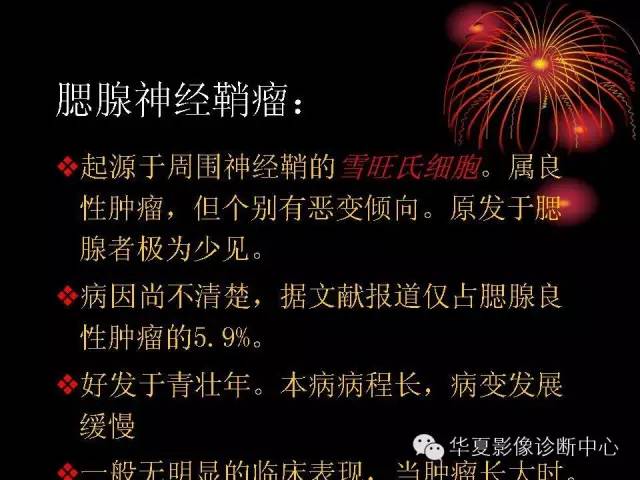 【病例】腮腺常见病变影像诊断