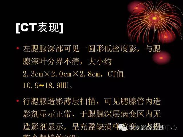 【病例】腮腺常见病变影像诊断