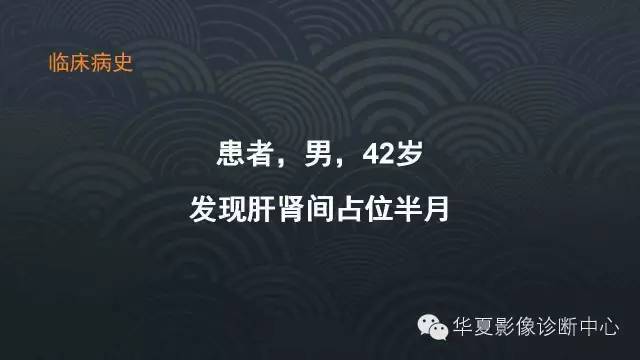 【病例】肾上腺血管平滑肌脂肪瘤1例CT影像表现