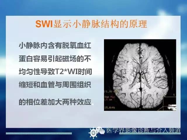 自动草稿
